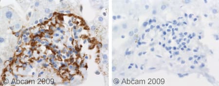 Anti-C5b-9 antibody(AB55811)