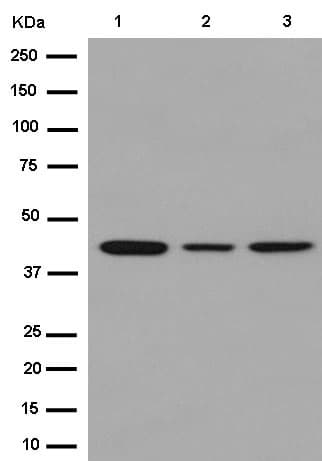 Cd1e Antibody Epr15746b Bsa And Azide Free Ab250917  Western Blot Img106712