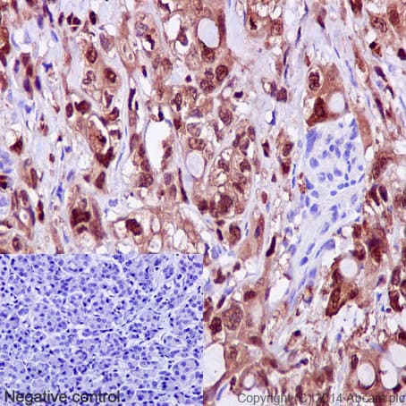 Anti-S100P antibody [EPR6142](AB124743)