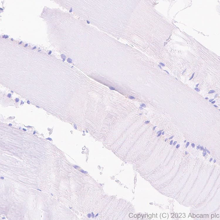 Hnf1 Alpha Antibody Rm1094 Bsa And Azide Free Ab316871  Immunohistochemistry Formalin Pfa Fixed Paraffin Embedded Sections Img428284