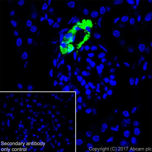 Anti-Renin antibody [EPR20693](AB212197)