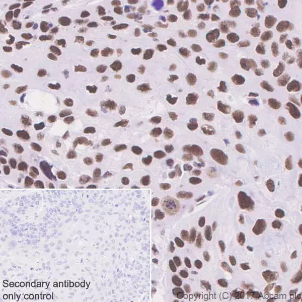 Anti-BRG1 antibody [EPNCIR111A](AB110641)