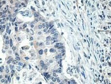 Scel Antibody Ab197087  Immunohistochemistry Formalin Pfa Fixed Paraffin Embedded Sections Img135134