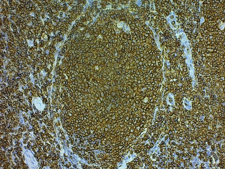 Mouse and Rabbit Specific HRP/DAB IHC Detection Kit - Micro-polymer(AB236466)