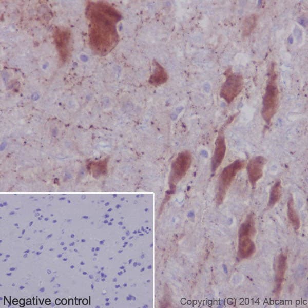 Anti-Choline Acetyltransferase antibody [EPR16590](AB178850)