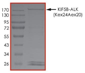 Recombinant human GST-KIF5B-ALK fusion protein (Active)(AB268705)