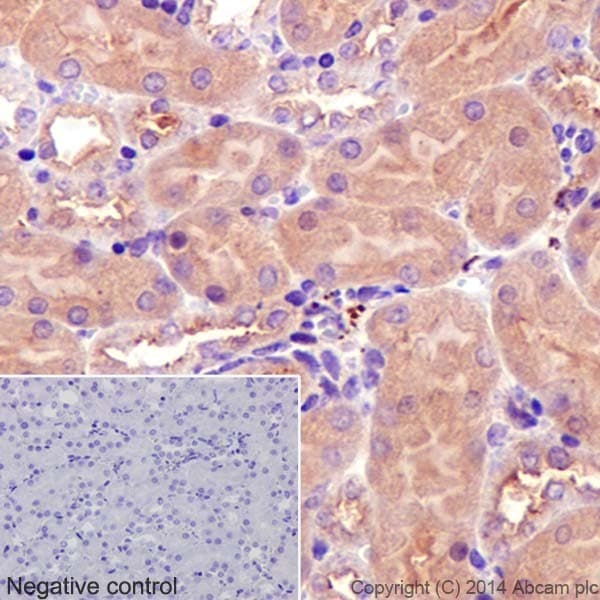 Anti-alpha Tubulin antibody [EP1332Y] - Microtubule Marker(AB52866)
