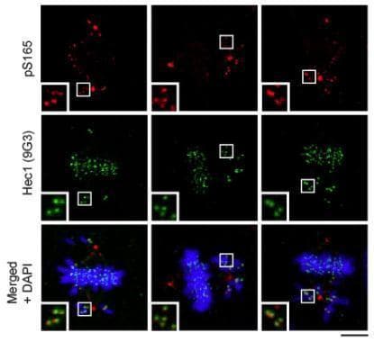 Anti-HEC1/HEC (phospho S165) antibody(AB233459)