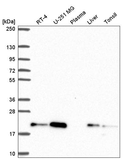 Cnbp Antibody Ab272676  Western Blot Img102282