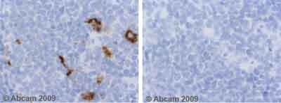 Anti-Semaphorin 3A antibody(AB23393)