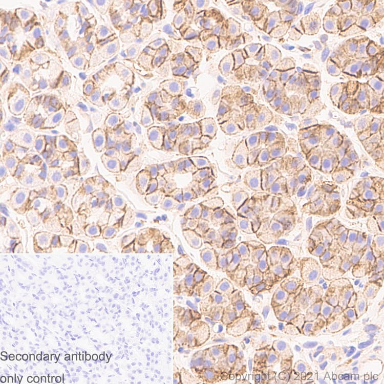 Anti-Sodium Potassium ATPase antibody [EP1845Y] - Rat IgG2a (Chimeric)(AB283345)