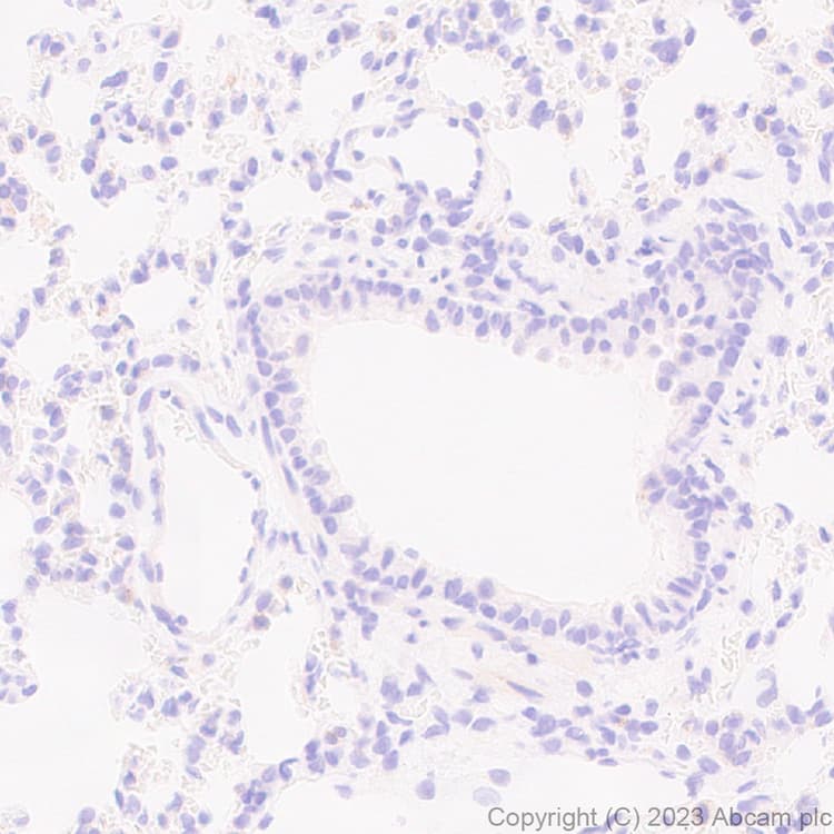 Anti-MATH2/NEUROD6 antibody [EPR28660-23](AB315812)