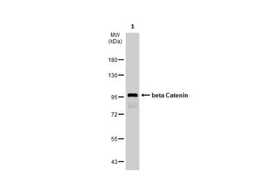 Anti-beta Catenin antibody - ChIP Grade(AB227499)