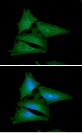 Leptin Antibody At7e10 Ab219260  Immunocytochemistry Immunofluorescence Img47059