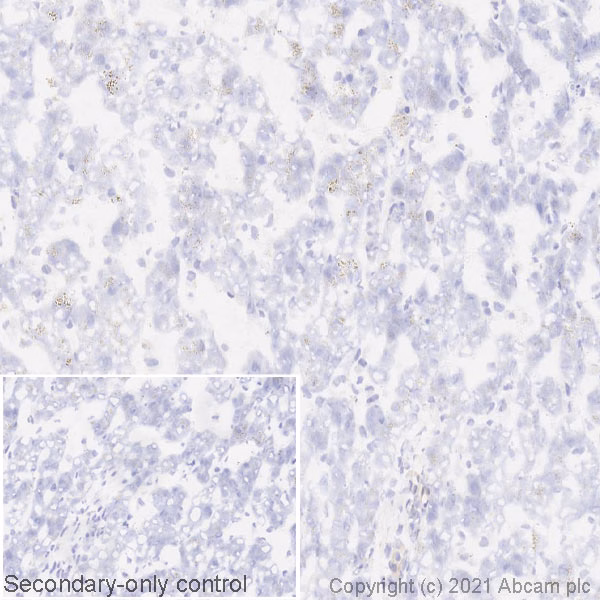 Alpha Synuclein Antibody Mjfr1 Bsa And Azide Free Ab209420 Immunohistochemistry Frozen Sections Img182872