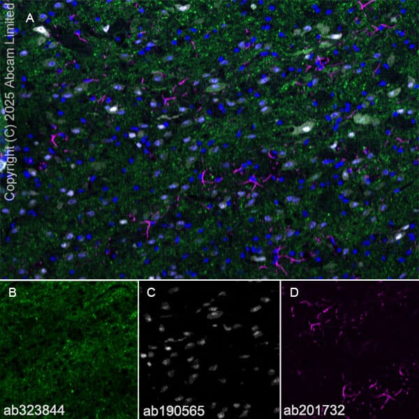 Alexa Fluor® 594 Anti-GFAP antibody [EPR1034Y](AB201732)