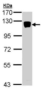 Anti-XYLT2 antibody(AB155193)