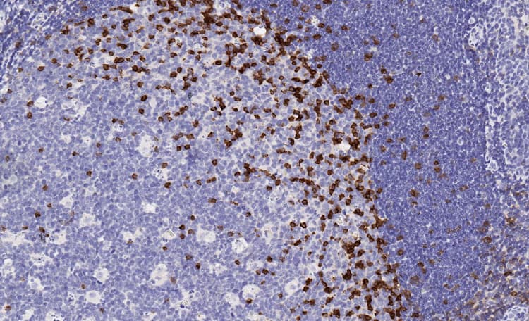 Anti-PD1 antibody [EPR4877(2)] - BSA and Azide free(AB186928)