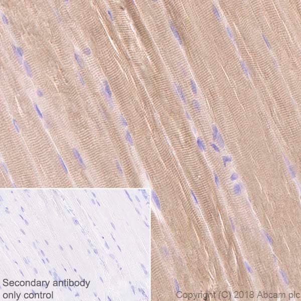 Anti-Ryanodine Receptor antibody [EPR21796](AB219798)