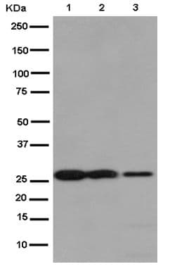 Claudin 17 Antibody Epr15483 Ab186744  Western Blot Img70298