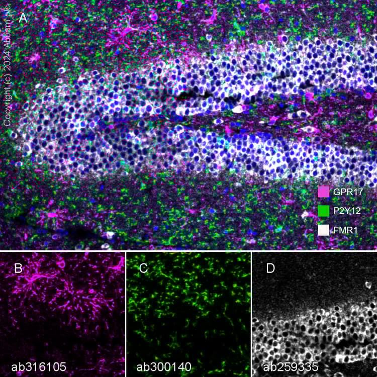 Anti-FMRP antibody [EPR23852-90] - BSA and Azide free(AB277489)