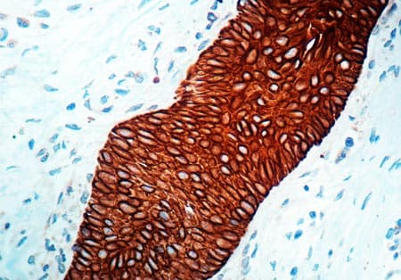 Anti-wide spectrum Cytokeratin antibody(AB9377)