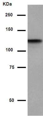 Anti-HIF-1 alpha antibody [EP1215Y](ab51608)