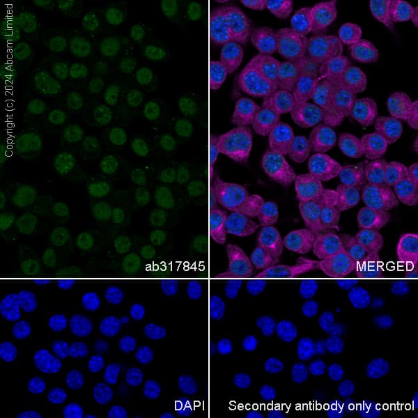 Dnmt1 Antibody Rm1192 Ab317845  Immunocytochemistry Immunofluorescence Img434437