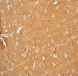 Anti-GabA B Receptor 2/GabBR2 antibody [EP2411Y](ab75838)