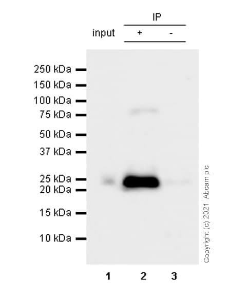 Anti-CBX1 / HP1 beta antibody [EPR24242-78](AB270988)