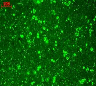 Anti-CACNA1C antibody [S57](AB84814)