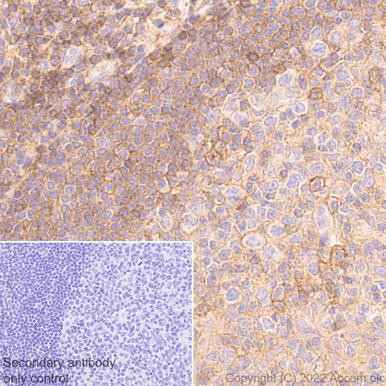 Cd47 Antibody Epr24922 5 Ab300435  Immunohistochemistry Formalin Pfa Fixed Paraffin Embedded Sections Img400679