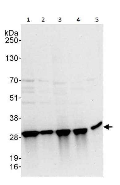 Triosephosphate Isomerase Antibody Ab240599  Western Blot Img25638