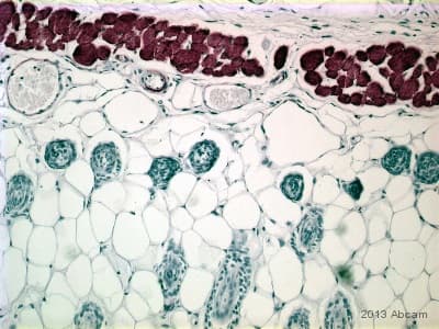 Anti-Desmin antibody - Cytoskeleton Marker(AB15200)