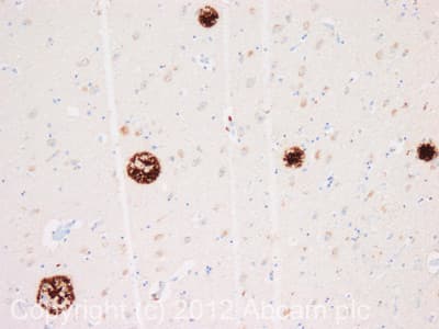 Anti-beta Amyloid antibody [MOAB-2](AB126649)