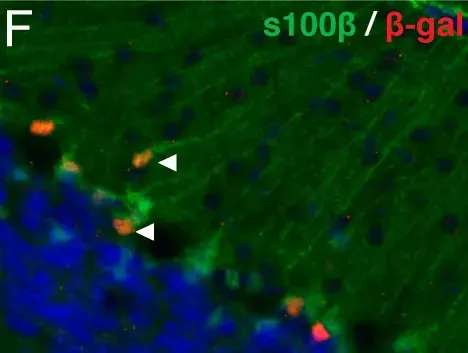 Anti-S100 beta antibody [EP1576Y] - Astrocyte Marker(AB52642)
