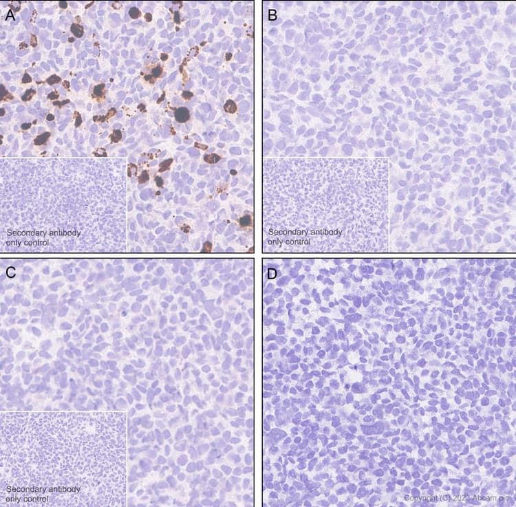 Anti-Mycobacterium tuberculosis Ag85B antibody [EPR28401-54] - BSA and Azide free(AB312329)