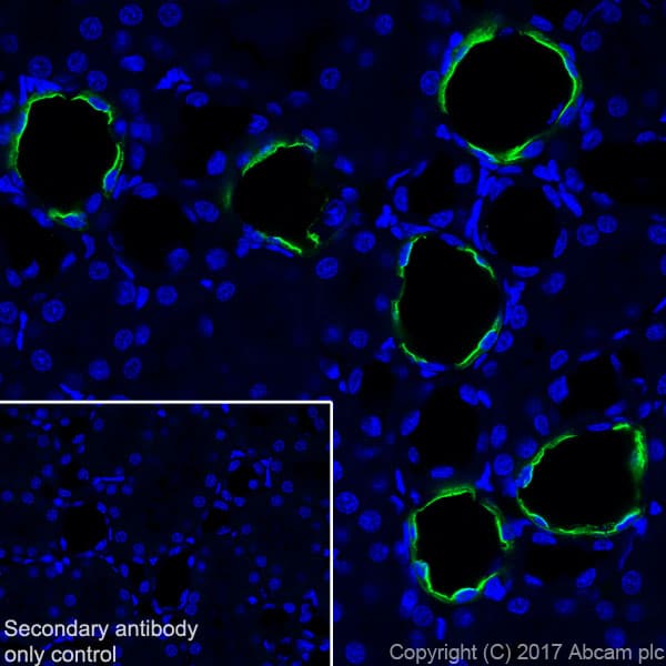 Anti-Aquaporin 2 antibody [EPR21080] - BSA and Azide free(AB230170)