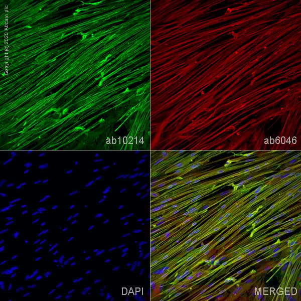 ioSkeletal Myocytes - Human iPSC derived cells(AB277612)