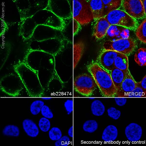 Anti-SLC34A2 antibody [SP322] - N-terminal(AB228474)