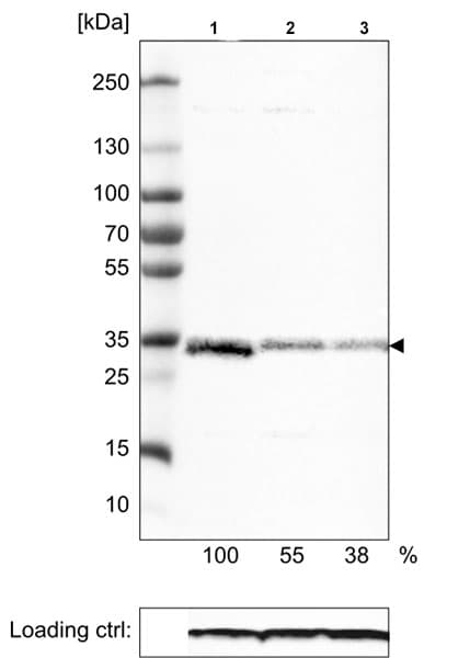 Mcu Antibody Cl3576 Ab219827  Western Blot Img42538