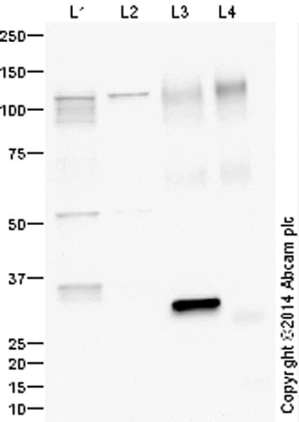 Anti-LAMP2A antibody - Lysosome Marker(AB18528)