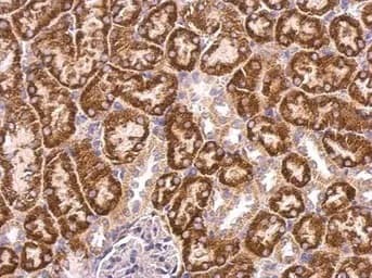 Abat Gaba T Antibody Ab152134  Immunohistochemistry Formalin Pfa Fixed Paraffin Embedded Sections Img452078