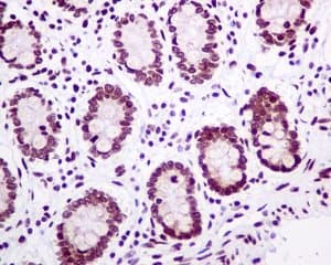 Mh2a1 Antibody Epr9358 Ab137117  Immunohistochemistry Formalin Pfa Fixed Paraffin Embedded Sections Img119271