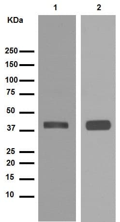 Anti-Synaptophysin antibody [YE269](ab32127)