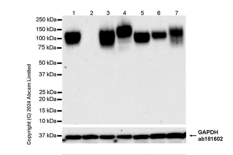 Anti-LAMP1 antibody [RM1217](AB320851)