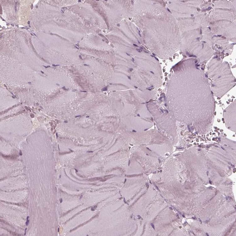 Krt79 Antibody Ab254953  Immunohistochemistry Formalin Pfa Fixed Paraffin Embedded Sections Img108980