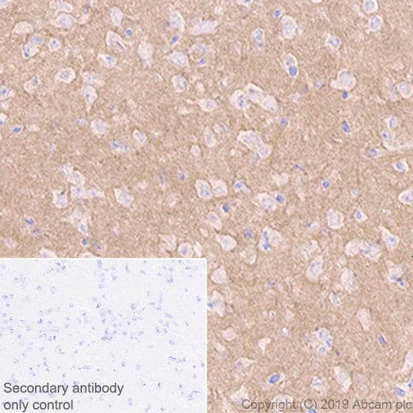 Anti-Pan Trk antibody [EPR17341-4](ab246551)