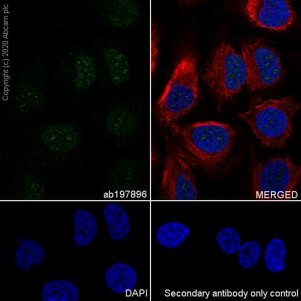 Anti-S100A4 antibody [EPR14639(2)](AB197896)