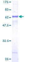 Recombinant Human beta Sarcoglycan protein(AB152676)
